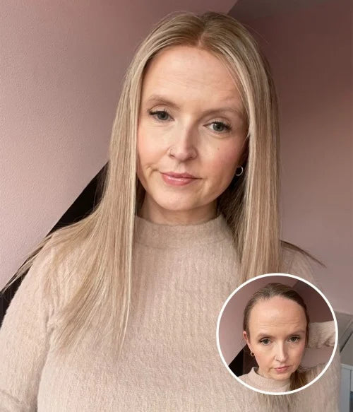 Human Hair Lace Hairline Topper with Bangs for Receding Hairline 1.5"x11"