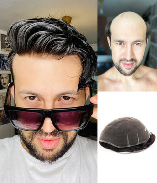 MERCURY-- SWISS LACE HAIR REPLACEMENT SYSTEM FOR MEN MOST BREATHABLE | FOR SUMMER